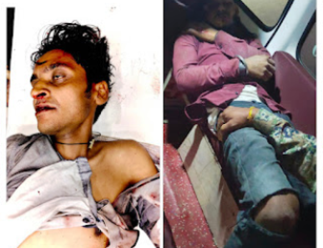 धमतरी में सड़क हादसा: अज्ञात बाइक की टक्कर से एक युवक की मौत, दूसरा गंभीर…