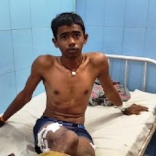 सुपेला मड़ई में मोबाइल विवाद ने लिया हिंसक रूप, युवक गंभीर घायल…