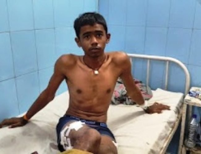 सुपेला मड़ई में मोबाइल विवाद ने लिया हिंसक रूप, युवक गंभीर घायल…