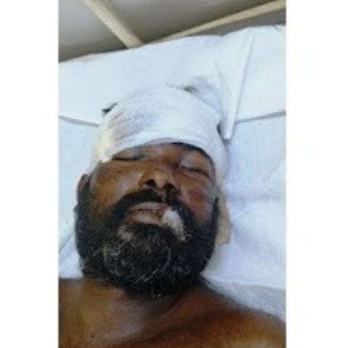 22 साल के दो नवयुवकों ने की खुदकुशी, एक अन्य घटना में घायल व्यक्ति की मौत…