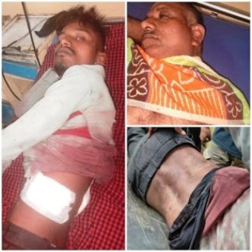 🔪 मामूली बात बनी खूनी संघर्ष का कारण: ग्राम गुजरा में बाप-बेटे पर चाकू से हमला, तीन आरोपी गिरफ्तार…
