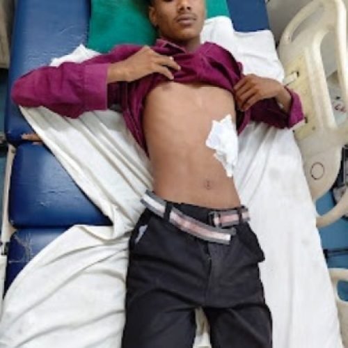 गांजा बेचने वाले का पता पूछने पहुंचे युवकों ने नाबालिग पर किया चाकू से हमला…