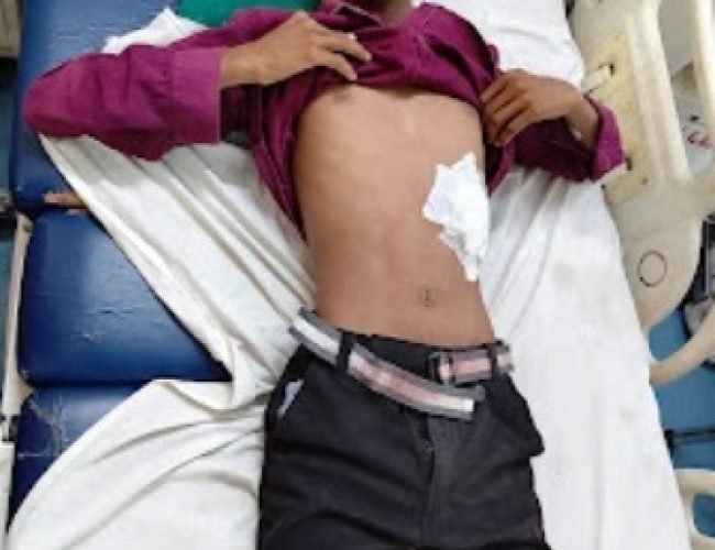 गांजा बेचने वाले का पता पूछने पहुंचे युवकों ने नाबालिग पर किया चाकू से हमला…