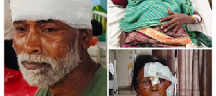 धमतरी: तेंदुए का आतंक, कारीपानी में दो महिलाओं समेत तीन ग्रामीण घायल; दो जिला अस्पताल रेफर…
