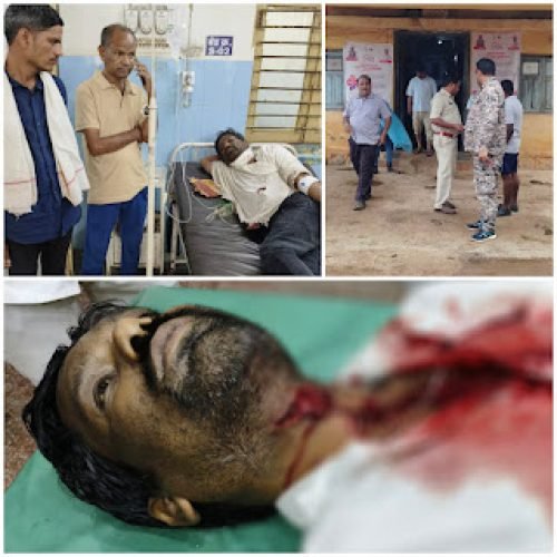 #RUDRI: जल संसाधन विभाग में चौकीदार पर जानलेवा हमला, गले में गहरे जख्म, खून से लथपथ हालत में खुद पहुंचा थाने