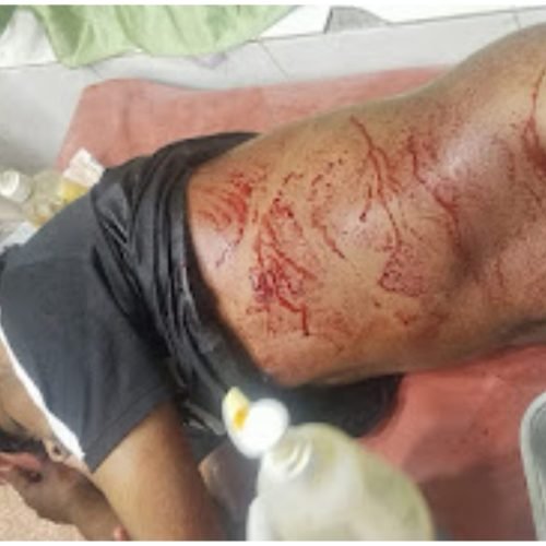 धमतरी में सड़क विवाद बना खूनी संघर्ष: बाइक सवार ने युवक को चाकू मार किया घायल, रायपुर रेफर बांसपारा में कहासुनी के बाद हमलावर फरार, आरोपी गिरफ्तार